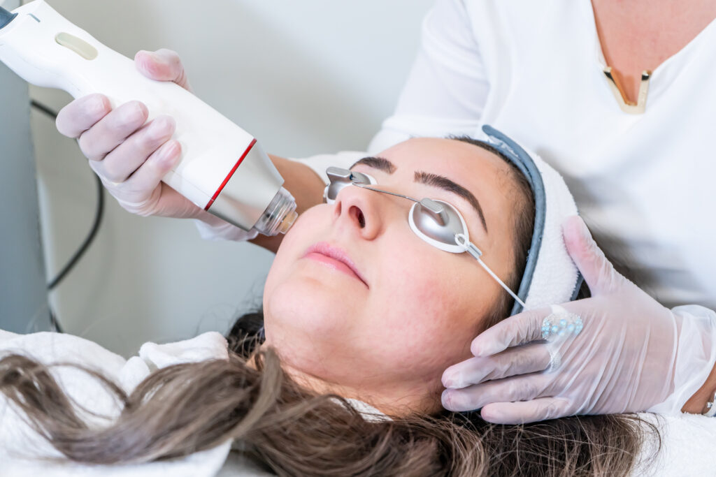 Revitalize Your Skin Exploring the Benefits and Advancements of Fraxel Laser Therapy in Brooklyn, NY